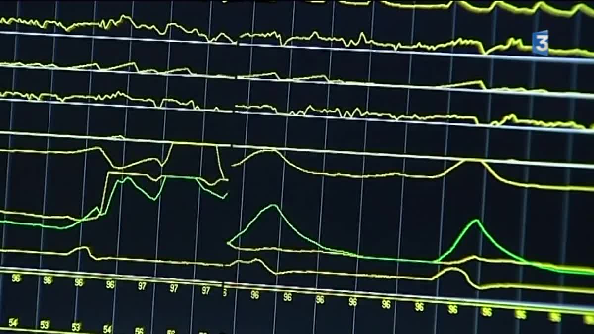 Une infirmière enregistre le sommeil d'un patient dans le laboratoire du sommeil de la clinique de Saint-Odilon de Moulins.